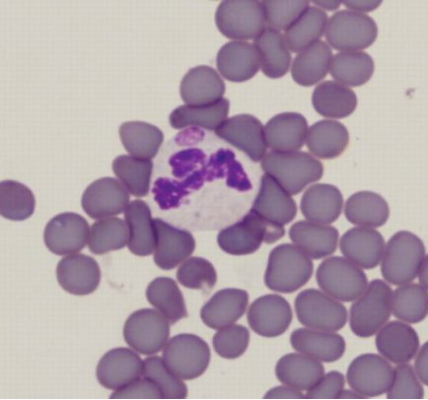 Más Allá de la Garrapata: Diagnóstico y Prevención de la Anaplasmosis Bovina, un Desafío Silencioso en el Campo